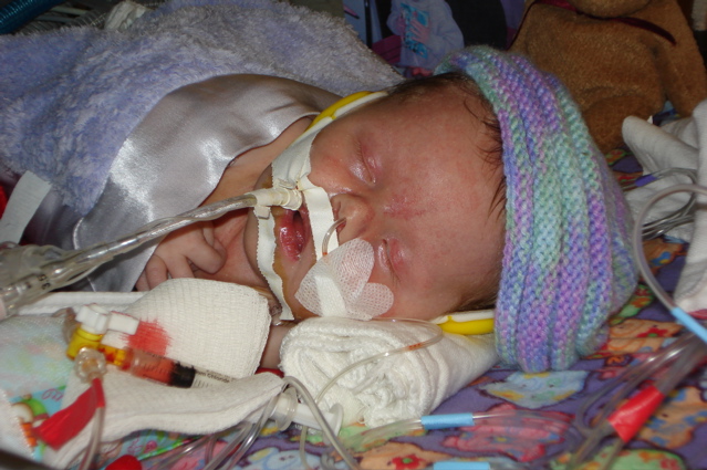 Molly at Packard's Childrens Hospital 004