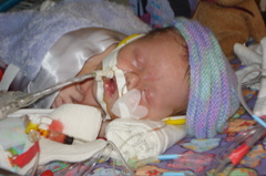 Molly at Packard's Childrens Hospital 004